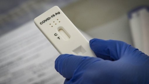 Covid-19: Sem testagem sistemática é “muito mais difícil” monitorizar - investigador