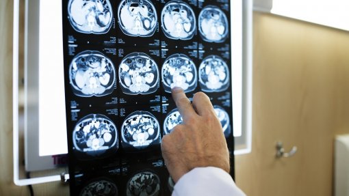 Concorrência multa em 5 ME empresa do grupo Unilabs por cartel na telerradiologia