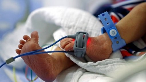 Centro Materno Infantil do Norte com nova máquina para fazer diálise a recém-nascidos