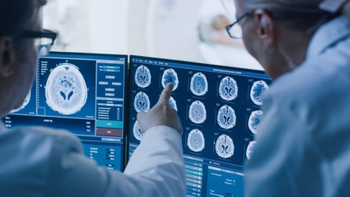 Concorrência acusa Affidea, Lifefocus e G54 de cartel na telerradiologia a hospitais
