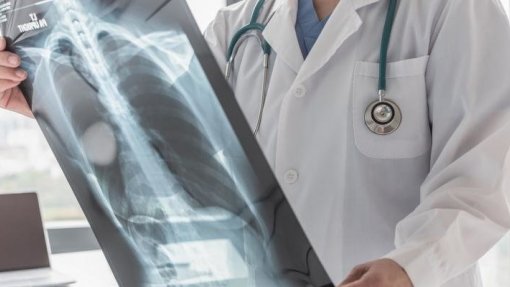 Exames de radiologia custam 123 ME e são a terceira despesa convencionada do SNS