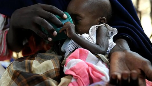 Metade das crianças com menos de 5 anos sofre de desnutrição aguda na Somália