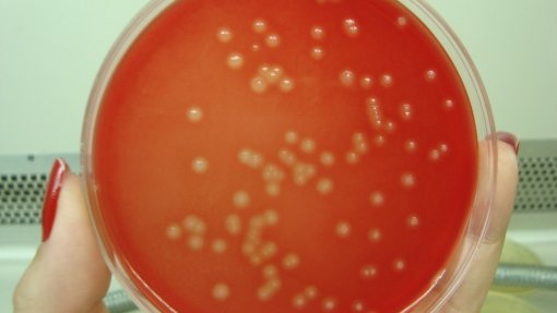 Número de crianças mortas no Reino Unido em surto de infeção bacteriana sobe para 21