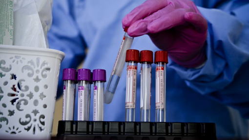 Covid-19: Investigadores sul-africanos consideram que XBB.1.5 não é variante de preocupação