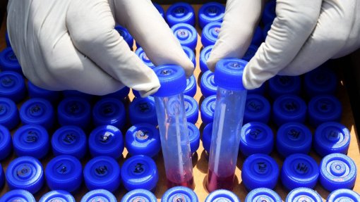 Covid-19: Infetados com maior risco de doença cardiovascular e morte a longo prazo