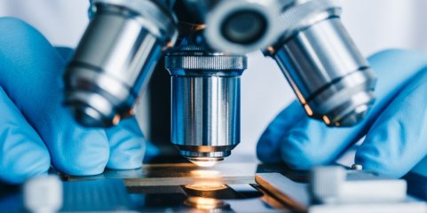 Investigadores desvendam alterações que desencadeiam aparecimento de Lúpus