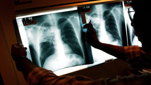 Menos tuberculose em África mas metas para acabar com as mortes estão em risco - OMS