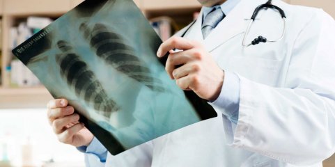 Pneumoscópio faz dois anos e alerta que “morre-se muito de pneumonia” em Portugal