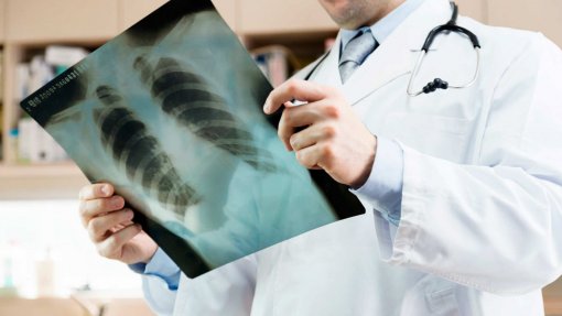 Pneumoscópio faz dois anos e alerta que “morre-se muito de pneumonia” em Portugal