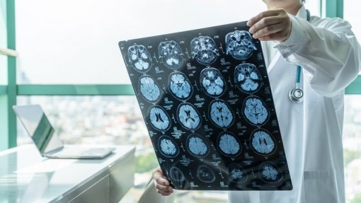 Investigadores querem tratar doenças neurológicas intervindo diretamente no cérebro