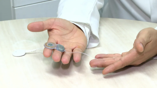 Hospitais de Coimbra atingem os 1.500 implantes cocleares