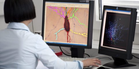 Empresa de Elon Musk vai testar implantes cerebrais em humanos
