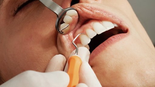 Região Norte terá 41 novos gabinetes de dentista nos centros de saúde