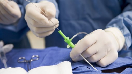 Hospital da Covilhã terá angiografia cardíaca - ministro