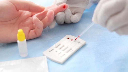 Sociedade Portuguesa apela a teste da hepatite C pelo menos uma vez na vida