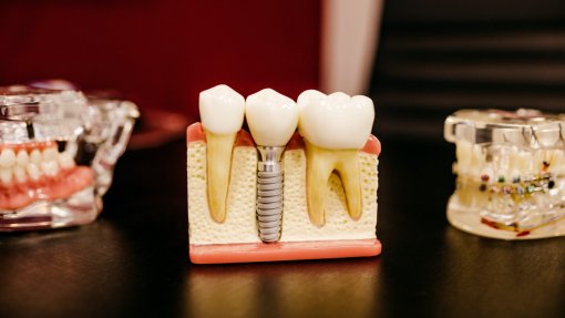 Ordem dos dentistas quer registo obrigatório de clínicas para reforçar ação disciplinar