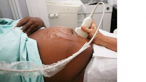 Mais de um quinto das mulheres negras em Portugal sofreu violência obstétrica - estudo