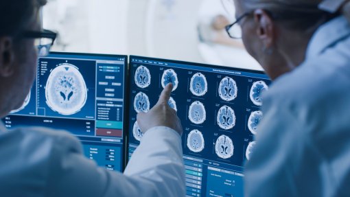 Teoria explica a relação entre complexidade cognitiva e assimetria cerebral