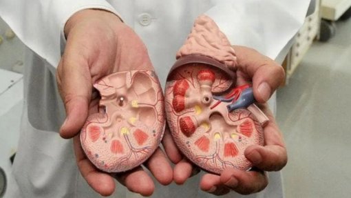 Experiência de rim de porco em humano termina com recorde de dois meses em funcionamento