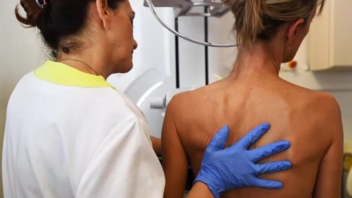 Açores com novo equipamento &quot;de última geração&quot; para realização de mamografias