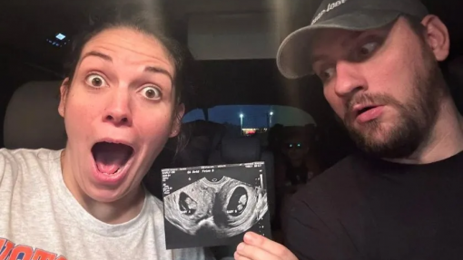 EUA: Mulher com dois úteros engravidou de gémeos e tem um bebé em cada
