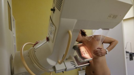 Novo mamógrafo no hospital de Vila Real permite mais exames e evita deslocações
