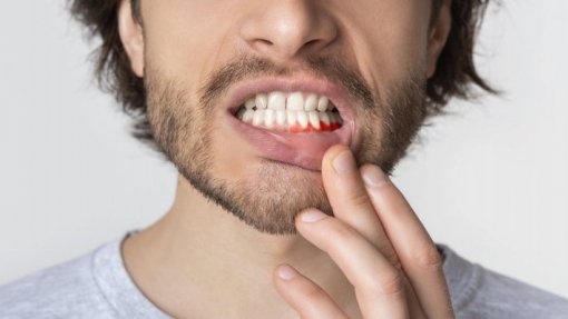 Ordem alerta para casos graves de autotratamento e pede regulamentação de alinhadores de dentes
