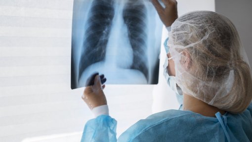 Portugal está no “nível zero” na luta contra o cancro do pulmão - sociedade pneumologia