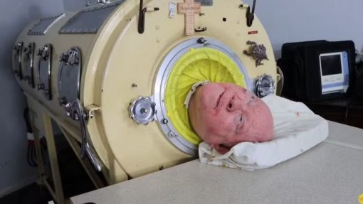 EUA: Morreu o ‘homem com pulmão de ferro’ que viveu ligado à máquina durante 70 anos