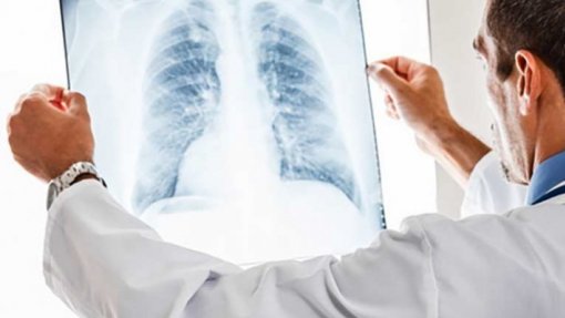 Covid-19: Região europeia da OMS registou mais 7.000 mortes por tuberculose na pandemia
