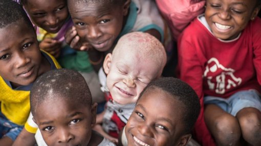 Lesoto deve implementar medidas que melhorem a qualidade de vida de pessoas albinas - ONU