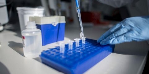 Cientistas criam células para tratamento da doença de Machado-Joseph