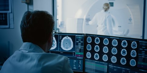 Exames convencionados de radiologia custaram mais de 100 ME ao SNS - regulador