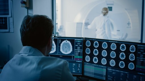 Exames convencionados de radiologia custaram mais de 100 ME ao SNS - regulador