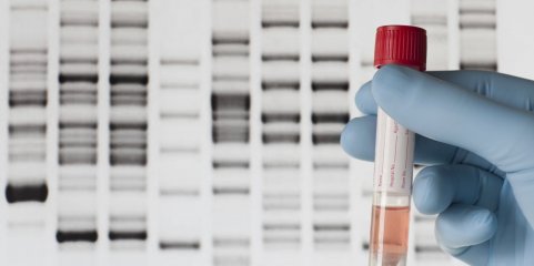 Identificada mutação genética que aumenta o risco de espinha bífida - Estudo