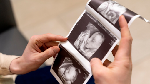 Identificada ‘ponte’ chave na comunicação genética do desenvolvimento craniofacial