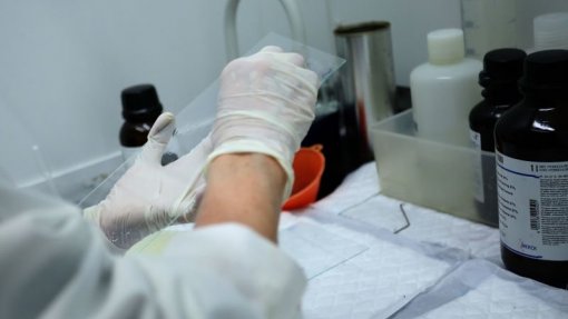 UA cria micropartículas com origem humana para aplicar na área da biomedicina