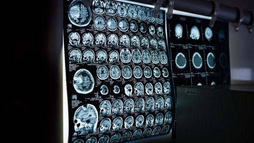 Hospital de Gaia investe 2,4ME e aumenta resposta em Radiologia e Neurorradiologia