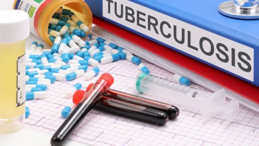 Programa Bolsa Família diminuiu em 65% as mortes por tuberculose no Brasil - investigacão