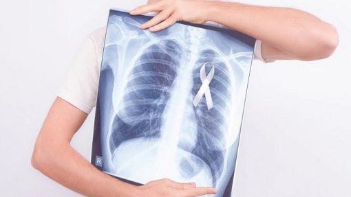Especialistas vão definir as referências para um futuro rastreio do cancro do pulmão