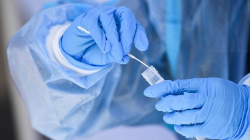 Covid-19: SNS mais bem preparado para pandemia mas falharia no acompanhamento a outros doentes - Administradores