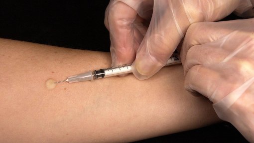 Portugal regista 22 casos de tuberculose multirresistente em 2023, o dobro de 2022