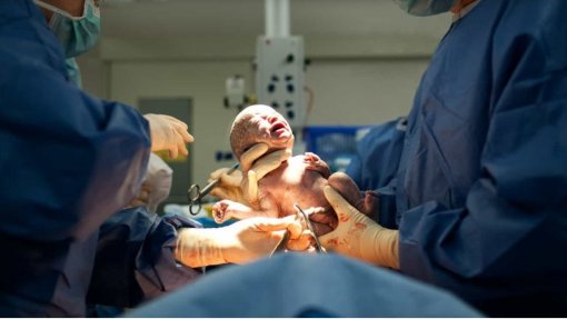 Partos assistidos em unidades médicas moçambicanas cresceram 93% desde 1985 - PR