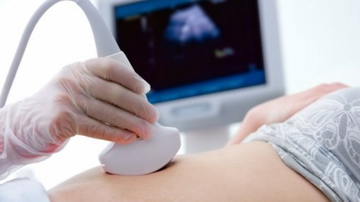 Triagem através do SNS Grávida serve para esconder anos de desinvestimento - médicos