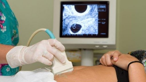Conselho da PMA alerta que inseminação caseira é crime