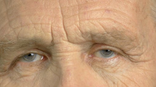 Autorizado fármaco para atrasar deficit cognitivo em doentes com Alzheimer na UE