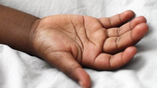 Cancro da pele continua a fazer vítimas entre albinos em Angola por falta de apoios - Associação