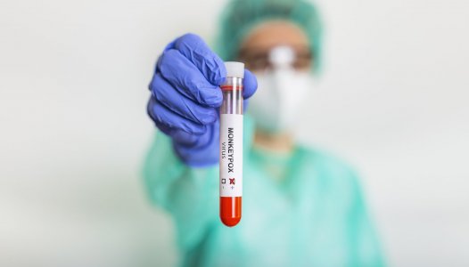 Mpox: Portugal é o sexto na Europa com mais casos entre 2022-2025 - relatório