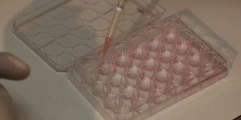 ULS Santa Maria trocou medicação de utente após análises clínicas - regulador