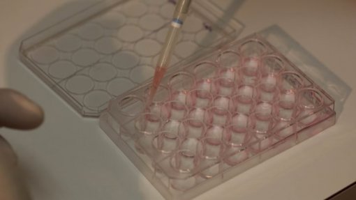 ULS Santa Maria trocou medicação de utente após análises clínicas - regulador